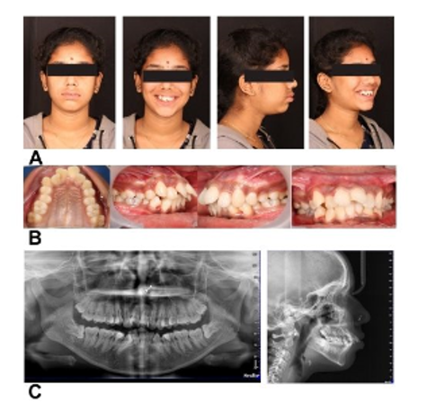 fig1