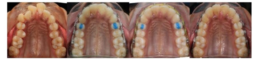 fig2